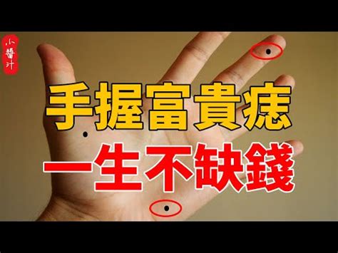 掌中痣右手|手相專家：掌痣暗示何事？